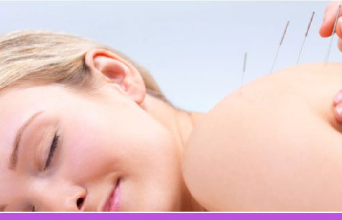 Acupuncture-Banner-Coral-Gables-FL